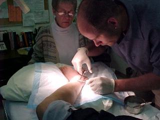 Robert Removes Stitches